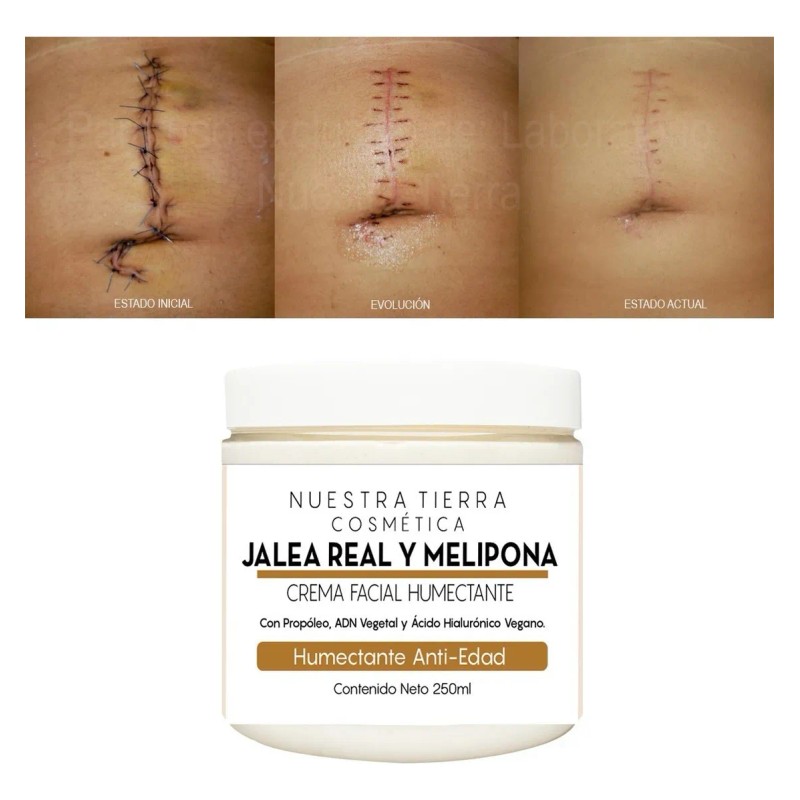 Crema Humectante-cicatrizante Anti-edad Jalea Real Melipona 250ml Todo Tipo De