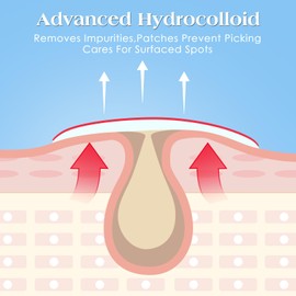 AUSLKA AUSLKA Large Pimple Patches (22 Strips), Hydrocolloid, XL-Invisible-Ultra Thin Spot Stronger Absorption, Long Size, Suitable For Larger-area Outbreaks