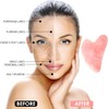 Sha Facial Treatment with Rose Quartz Heart Shape Guasha Board