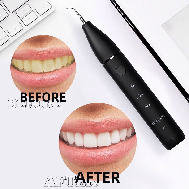 Meyarn Sonic Electric Dental Plaque Remover