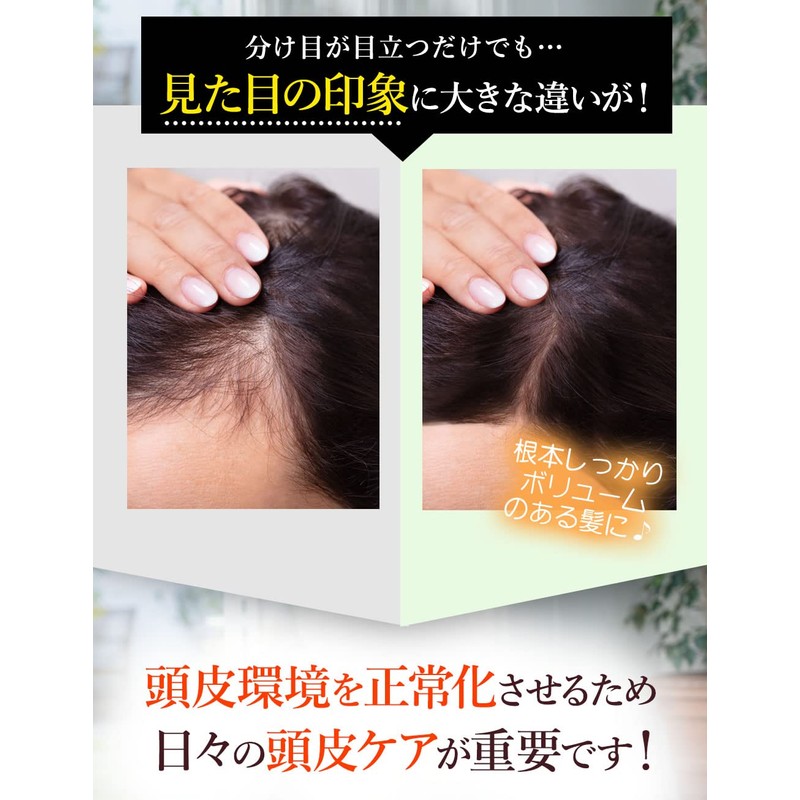 STAY FREE ROCKY SCALP ESSENCE Medicated Scalp Care Tonic [Quasi-Drug]