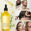 Juego de 5 PCS Aceite Natural Para el Crecimiento del