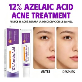 Acido Azelaico Suero Facial 12% Hialurónico Crema 3pcs Hidratante Reduce Rojeces e Imperfecciones Rejuvenece la Piel