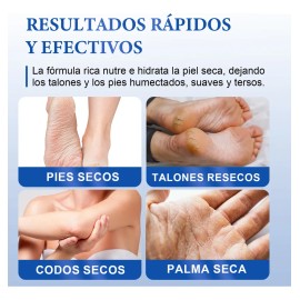 Set Crema Y Exfoliante Para Pies Con Urea 40% Y 60%