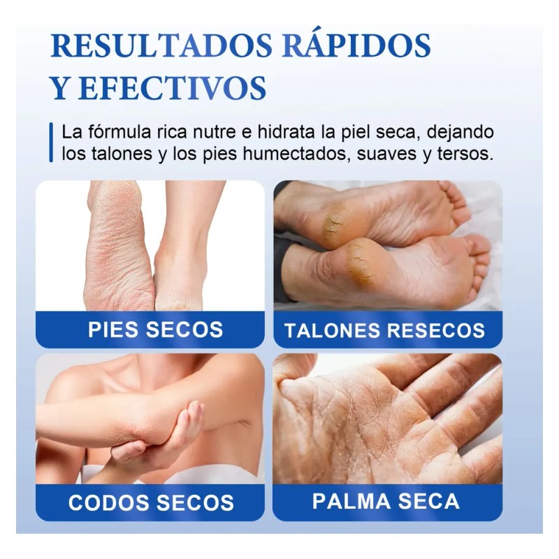 Set Crema Y Exfoliante Para Pies Con Urea 40% Y