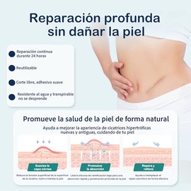 Parches de Silicona para Cicatrices - Reduce Quemaduras, Queloides, Estras y Acn, Cinta Reutilizable Postquirrgica,1.5M Largo, Antiguas y Nuevas (1)  