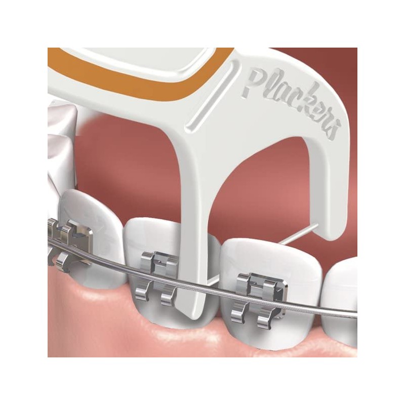 Plackers Orthopick - Hilo dental para tirantes, paquete de 2