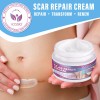 Scar Crema Vogsig Cicatrices Quirúrgicas Acné Quemaduras