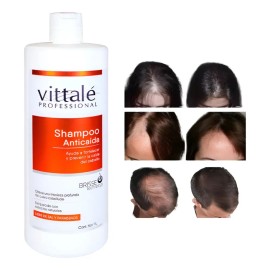 Shampoo Anticaida 1 Lt Vittale Professional