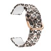 Tznzxm Replacement Bands Compatible with Spade & Co Health Smartwatch