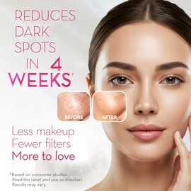 Cicatricure Crema Hidratante Facial Iluminadora Antimanchas, Resultados en 4 semanas, Crema Desvanecedora para Manchas Oscuras con Ácido Tranexámico, Potencia el Brillo y la Luminosidad, Luminosidad