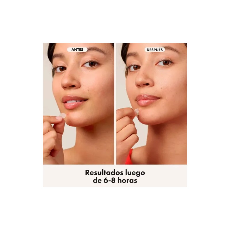 Hero cosmetics mighty patch parches para acné y espinillas