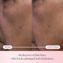 ELEMIS Pro-Collagen Rose Micro Serum 30ml - Anti-Aging Serum, Reduces Fine Lines & Wrinkles, Boosts Skin Radiance, Hydrates & Firms Skin, for Sensitive & Mature Skin