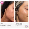 TOPICALS FADED Serum Vegan, Gluten-Free and Cruelty-Free- 1.7OZ/50ML(NEW VERSION)
