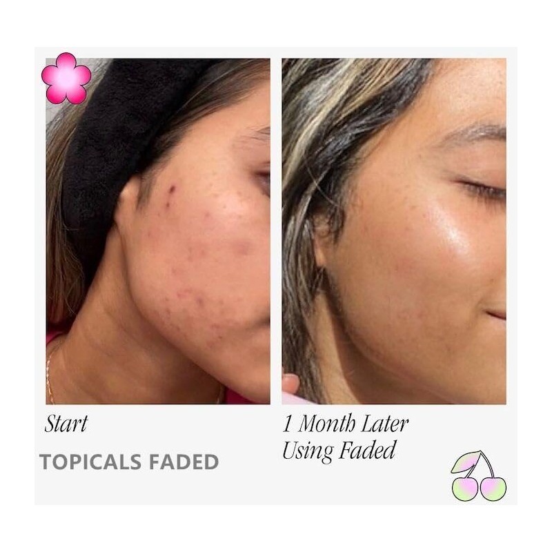 TOPICALS FADED Serum Vegan, Gluten-Free and Cruelty-Free- 1.7OZ/50ML(NEW VERSION)