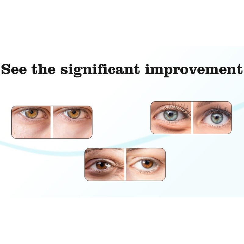 Luvanbliss Minty Chill Steam Eye Mask