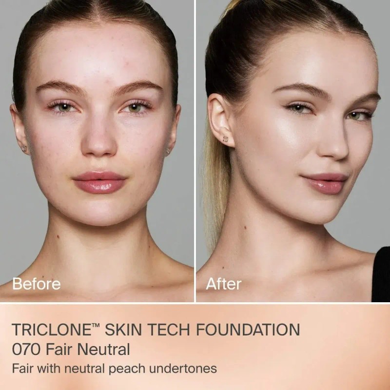 Base De Maquillaje Triclone Skin Tech De Cobertura Media H