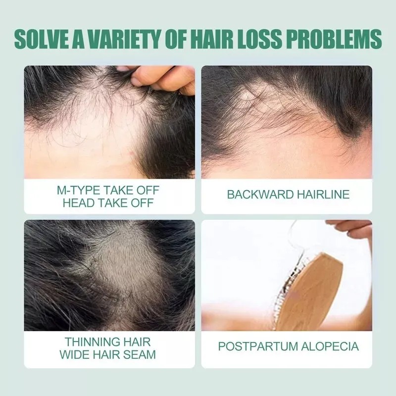 Tratamiento Para Exceso Caida Cabello Mujer Fortalece 30ml