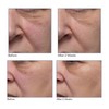 QVC ELEMIS Dynamic Resurfacing Facial Pads Home & Away Set
