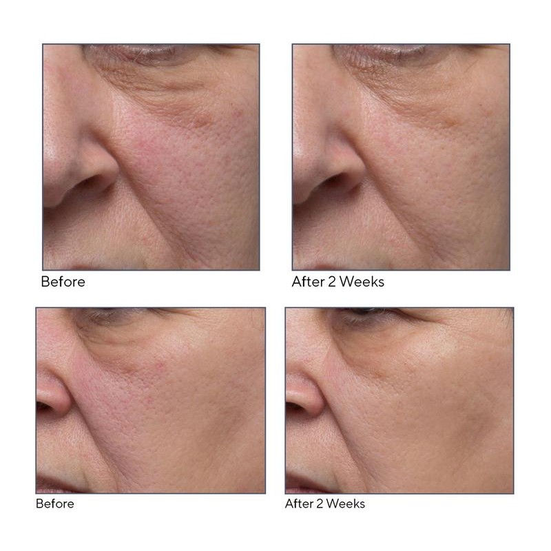QVC ELEMIS Dynamic Resurfacing Facial Pads Home & Away Set