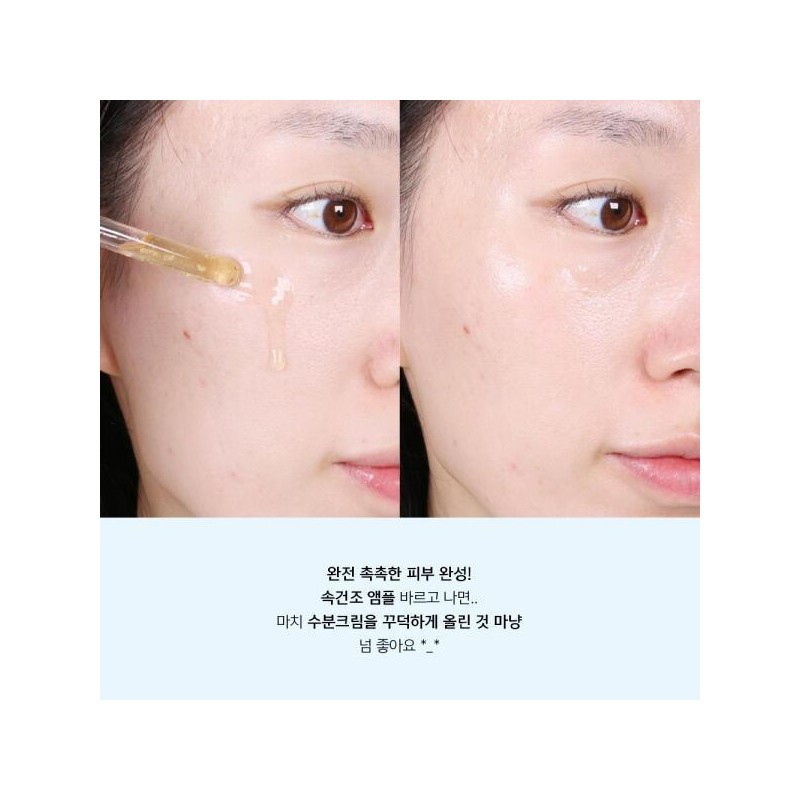 Anacis 아트박스/아나시스 리더미스 리싱크 악건성 속건조 히알루론산 앰플 55ml ArtBox/Anasis
