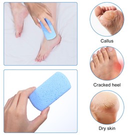 XLIUAX Pack of 4 Pumice Stone Foot Care, Double-Sided Pumice Stone Callus Remover Whetstones for Removing Dead Skin, Callus, Cuticle, Pedicure and Smooth, Soft Feet and Body Skin