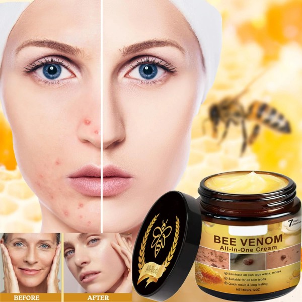 Unbranded Bee Venom Comprehensive Cream, Bee Venom Skin Treatment Cream,