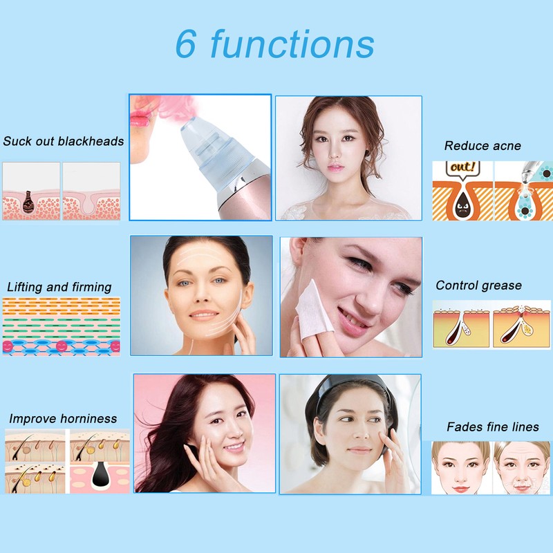 Rechargeable Electric Blackhead Removal Machine Vacuum Suction Face Pore CleanerChampagne