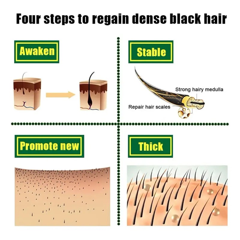 Sérum Para El Crecimiento Del Cabello, 1 Dosis De Aceite