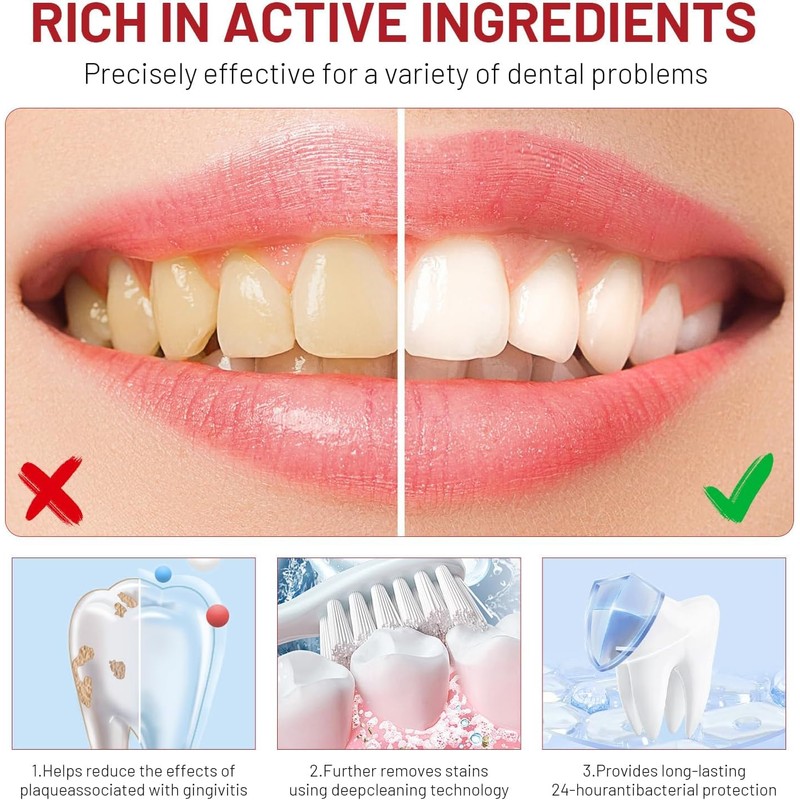 Sp10 Probiotic Toothpaste,SP-10 Toothpaste Probiotic Ultra-Whitening,Sp10 Toothpaste,Sp-10 Ultra Whitening Toothpaste,Fresh