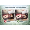 Pet Guru Disposable Dental Cleaning Finger Wipes for Dogs &