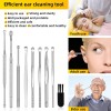 mamakoi 9 Pcs Ear Pick Earwax Removal Kit, Ear Cleansing