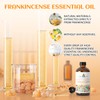 EVOKE OCCU Frankincense Essential Oil for Discomfort Relief, Skin Care,