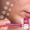 Essenze.me - Don't Pop Patch Hydrocolloidal Anti-Acne and Pimples -