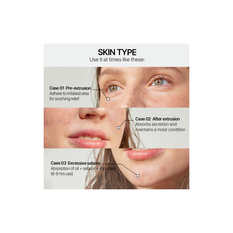 PARNELL [PARNELL]Cicamanu Clear Patch (48ea)