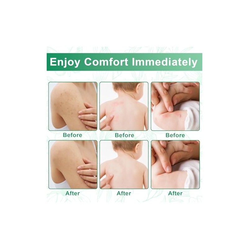 Herbal Antifungal Cream