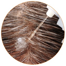 Tamashii Hair Growth Extract, 4.1 fl oz (120 ml), Damask Rose Scent, Women's Hair Growth Agent (Made by Hair Diagnosts), Promotes Hair Growth, Prevents Hair Loss, Formulated with Beautiful Ingredients