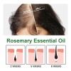 Aceite Esencial De Romero Para El Crecimiento Del Cabello