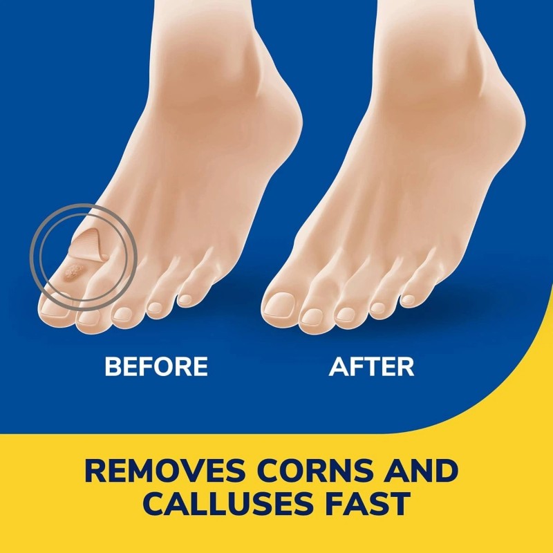 Dr. Scholl's Liquid Corn & Callus Remover, 0.33 Ounce Removes