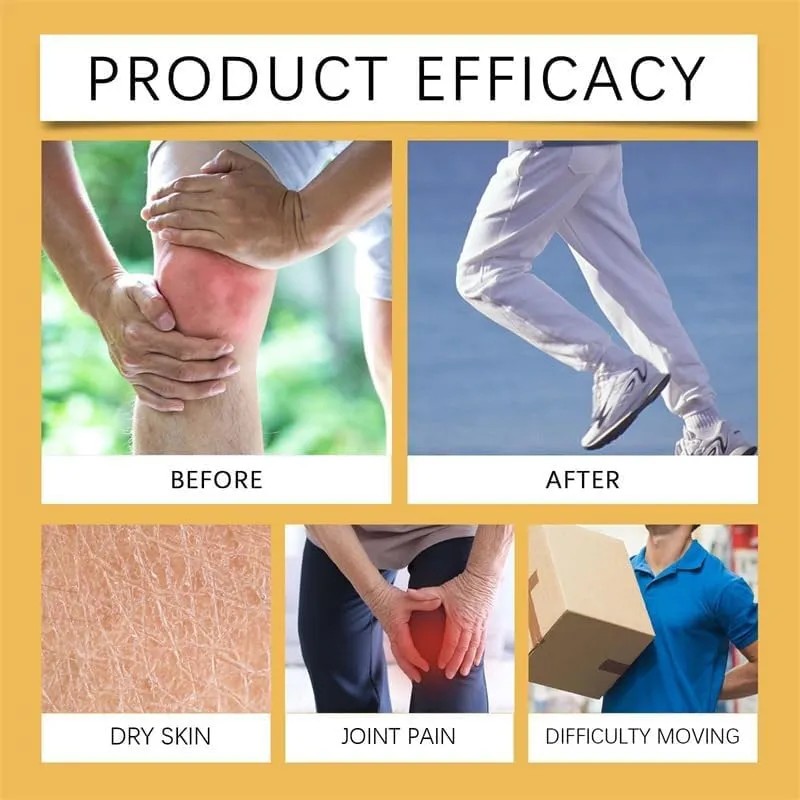 La Crema Para El Cuidado De Las Articulaciones Nutre Las