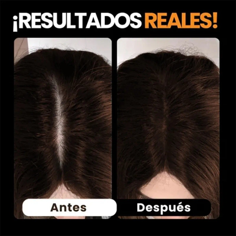 Polvo De Maquillaje De Fibra Capilar Cubre Raíz De Cabello