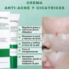 Dci Acne Solucion + Dermolimpiador+ Crema Bioaqua Salicilico