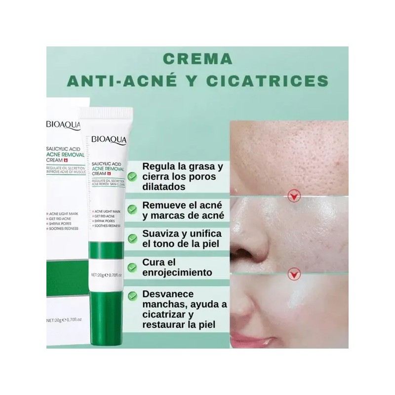 Dci Acne Solucion + Dermolimpiador+ Crema Bioaqua Salicilico