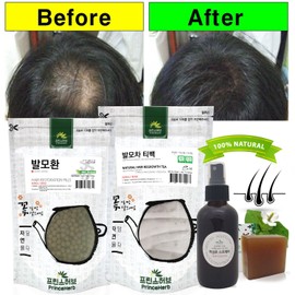 PrinceHerb 100% Natural Herbal Hair Restoration Complete Set for helping regrowth of hair