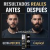 LWMaster - Kit 2 Tónico capilar Capixil 20% Anti-Caída estimula