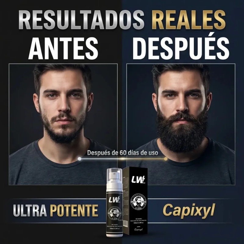 LWMaster - Kit 2 Tónico capilar Capixil 20% Anti-Caída estimula