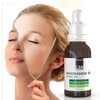 ican london Niacinamide 10% + Zinc 2% For Face Blemish