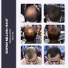 Super Million Hair - 1 x 15g Hair Building Fibres