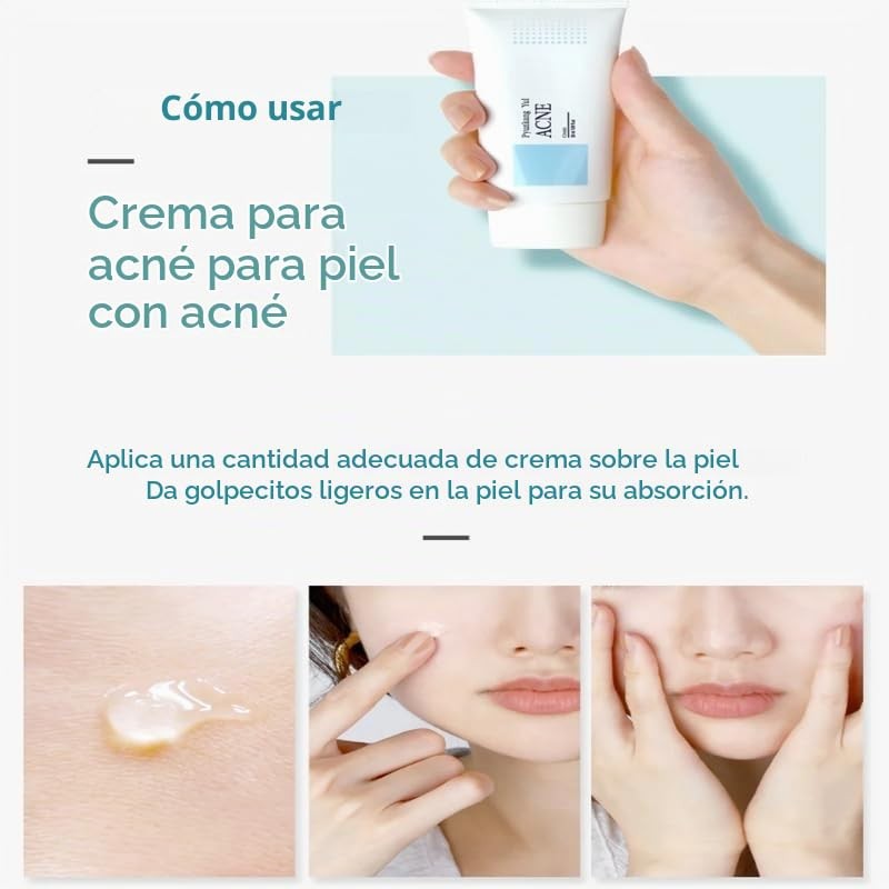 Pyunkang Yul - Crema para acné (50 ml)