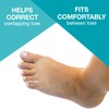 Steins Foam Corn Pads, Toe Separators, Toe Pads, Corn Cushions